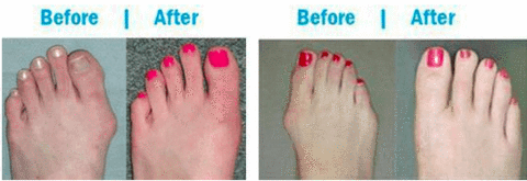 2023 Summer Breathable Sursell Sneakers Before and After 2023 Summer Breathable Sursell Sneakers Before and After